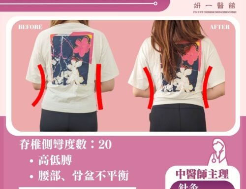 面對問題-假粗腰