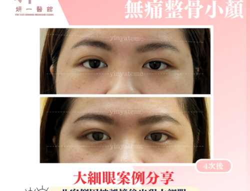 面對問題-大小眼