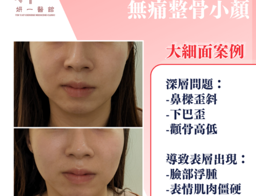 面對問題- 大細面