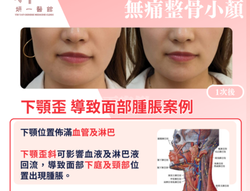 面對問題- 下巴歪 + 面部腫脹