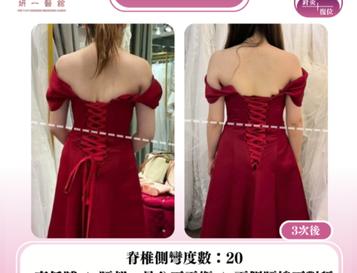 面對問題-脊椎側彎