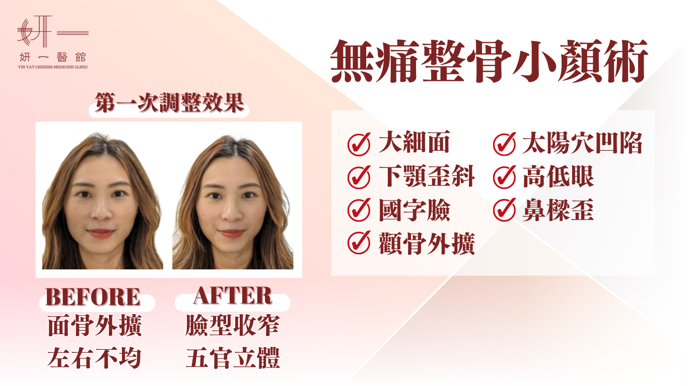 無痛整骨小顏術