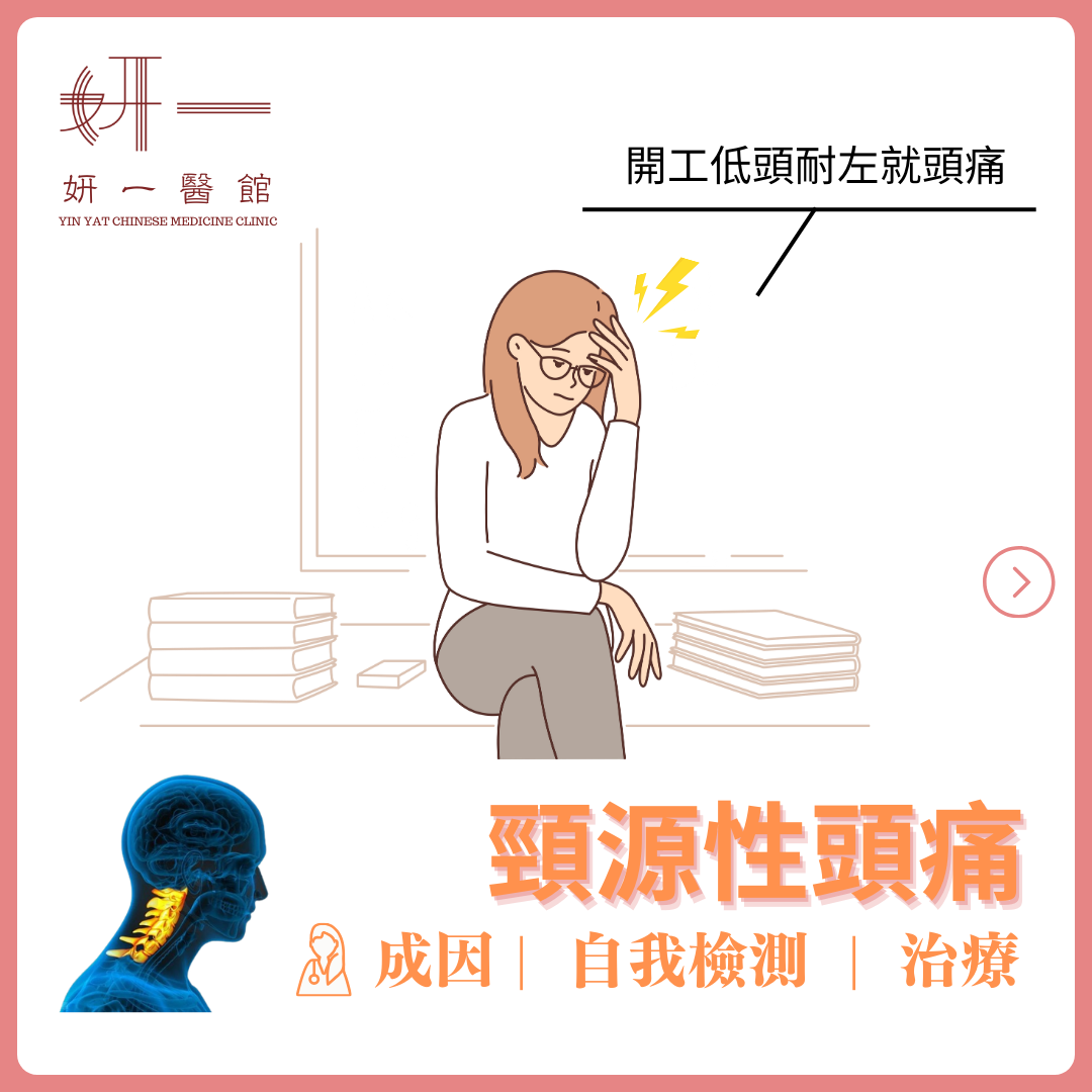 告別頸源性頭痛:中醫如何找出並治療根本原因?