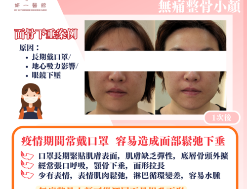 面對問題- 面骨下垂