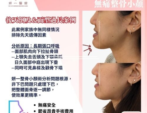 面對問題- 後天倒及面型過長