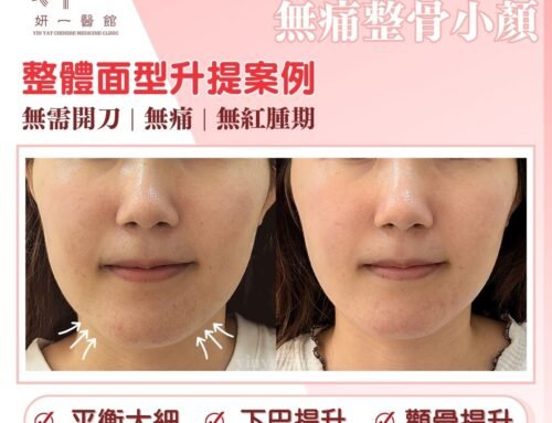 面對問題- 面部下垂