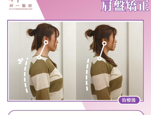 面對問題- 寒背/頭頸前傾