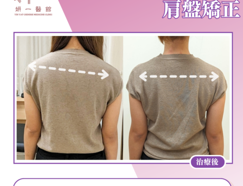 面對問題- 高低膊