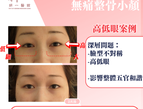 面對問題- 高低眼