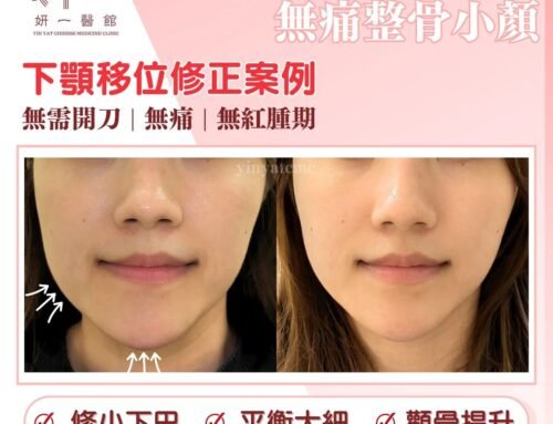 面對問題- 下顎移位