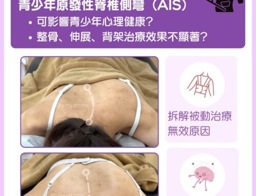 為什麼需要關注青少年特發性脊椎側彎?